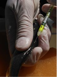 Figure 1. Injection of visible implant elastomer