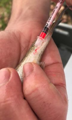 Figure 1. Injection of visible implant elastomer